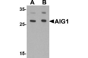 Western blot analysis of AIG1 in human brain tissue lysate with AIG1 antibody at (A) 1 and (B) 2 µg/mL. (AIG1 Antikörper  (N-Term))
