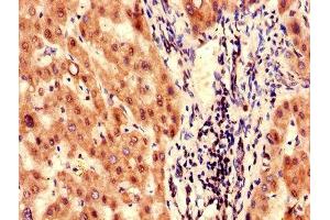 Immunohistochemistry of paraffin-embedded human liver tissue using ABIN7153235 at dilution of 1:100 (FAH Antikörper  (AA 2-250))