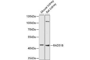 Western blot analysis of extracts of various cell lines, using RB antibody (ABIN6132613, ABIN6146640, ABIN6146643 and ABIN6222714) at 1:1000 dilution. (RAD51 Homolog B Antikörper  (AA 1-384))