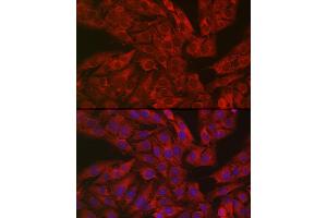 Immunofluorescence analysis of U2OS cells using GSDME antibody (ABIN6127757, ABIN6139554, ABIN6139555 and ABIN6223304) at dilution of 1:50. (Non-Syndromic Hearing Impairment Protein 5 (GSDME) (AA 1-260) Antikörper)