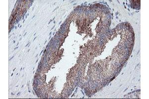 Image no. 12 for anti-Carboxypeptidase A2 (Pancreatic) (CPA2) antibody (ABIN1497596)
