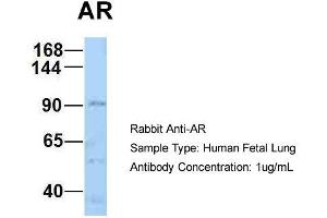 Host: Rabbit Target Name: AR Sample Type: Human Fetal Lung Antibody Dilution: 1. (Androgen Receptor Antikörper  (N-Term))