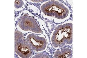 Immunohistochemical staining of human uterus, pre-menopause with OR2AE1 polyclonal antibody  shows distinct membranous positivity in glandular cells at 1:50-1:200 dilution.
