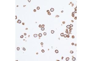 Immunocytochemistry (ICC) image for anti-Poliovirus Receptor (PVR) (AA 28-329) antibody (ABIN7449549) (Rekombinanter Poliovirus Receptor Antikörper  (AA 28-329))