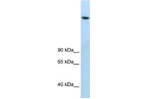 WB Suggested Anti-JMJD1B Antibody Titration:  2. (KDM3B Antikörper  (C-Term))