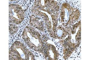 IHC analysis of CSNK2K2 using anti-CSNK2K2 antibody (ABIN7602871). (CSNK2A2 Antikörper  (C-Term))