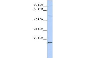 WB Suggested Anti-ZNF79 Antibody Titration:  0. (ZNF79 Antikörper  (N-Term))