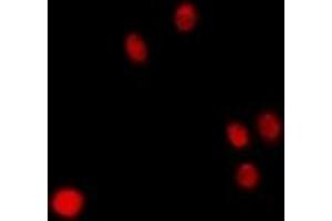 Immunofluorescent analysis of p47 staining in Hela cells. (CLEC11A Antikörper)