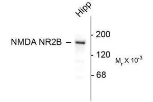 Image no. 1 for anti-Glutamate Receptor, Ionotropic, N-Methyl D-Aspartate 2B (GRIN2B) (C-Term) antibody (ABIN372682) (GRIN2B Antikörper  (C-Term))