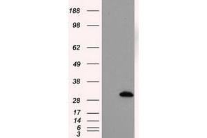 Image no. 1 for anti-Thiopurine S-Methyltransferase (TPMT) antibody (ABIN1501483)