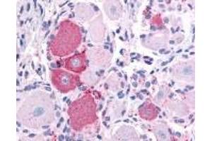 Immunohistochemistry (IHC) image for anti-Transient Receptor Potential Cation Channel, Subfamily V, Member 2 (TRPV2) (N-Term) antibody (ABIN2469502)