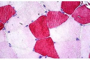 Human Skeletal Muscle: Formalin-Fixed, Paraffin-Embedded (FFPE) (UBE2O Antikörper  (AA 1279-1292))