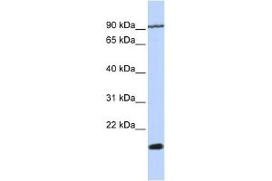 WB Suggested Anti-TM4SF4 Antibody Titration:  0. (TM4SF4 Antikörper  (N-Term))