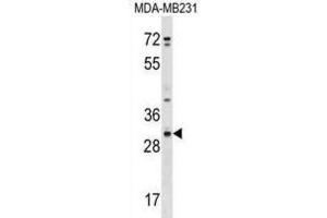 Western Blotting (WB) image for anti-Cysteine-Rich Secretory Protein 1 (CRISP1) antibody (ABIN2999601) (CRISP1 Antikörper)