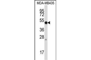 P28 Antibody (Center) (ABIN657656 and ABIN2846650) western blot analysis in MDA-M cell line lysates (35 μg/lane).