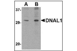 Western blot analysis of DNAL1 in 3T3 cell lysate with DNAL1 antibody at (A) 1 and (B) 2 µg/ml. (DNAL1 Antikörper  (C-Term))