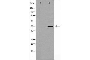 CRHR1 Antikörper  (Internal Region)