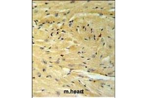 Immunohistochemistry (Paraffin-embedded Sections) (IHC (p)) image for anti-Guanine Nucleotide Binding Protein (G Protein), alpha Transducing Activity Polypeptide 1 (GNAT1) (AA 290-318), (C-Term) antibody (ABIN653740)