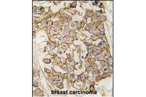 Immunohistochemistry (Paraffin-embedded Sections) (IHC (p)) image for anti-Receptor tyrosine-protein kinase erbB-2 (ErbB2/Her2) (AA 21-52), (N-Term) antibody (ABIN391945)