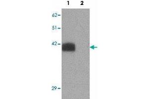 Western blot analysis of SLC39A2 in rat brain tissue lysate with SLC39A2 polyclonal antibody  at 1 ug/mL in (1) the absence and (2) the presence of blocking peptide.