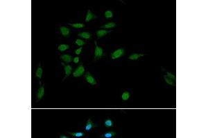 Immunofluorescence analysis of U2OS cells using PSMA1 Polyclonal Antibody at dilution of 1:100. (PSMA1 Antikörper)