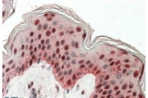 AP21273PU-N TIAL1 antibody staining of paraffin embedded Human Skin at 3. (TIAL1 Antikörper  (Internal Region))