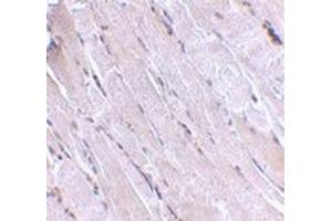 Immunohistochemistry of Wnt10b in human skeletal muscle with this product at 2.