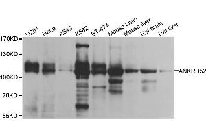 Western blot analysis of extracts of various cell lines, using ANKRD52 antibody. (ANKRD52 Antikörper)
