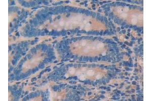 DAB staining on IHC-P; Samples: Rat Small intestine Tissue (ANGPTL2 Antikörper  (AA 47-207))