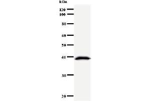 Western Blotting (WB) image for anti-Cyclin D Binding Myb-Like Transcription Factor 1 (DMTF1) antibody (ABIN930913) (DMP1 Antikörper)