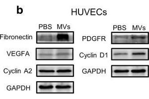 Effect of ASC-MV treatment on gene expression in all three kinds of cells. (Cyclin D1 Antikörper  (C-Term))