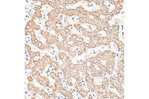 Immunohistochemistry of paraffin-embedded human liver using KIR3DS1 antibody. (KIR3DS1 Antikörper  (AA 80-340))