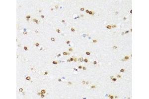 Immunohistochemistry of paraffin-embedded Mouse brain using DDX21 Polyclonal Antibody at dilution of 1:100 (40x lens). (DDX21 Antikörper)