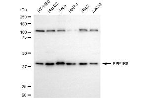anti-Protein Phosphatase 1, Regulatory Subunit 8 (PPP1R8) antibody