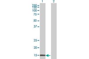 Western Blotting (WB) image for TSPO 293T Cell Transient Overexpression Lysate(Denatured) (ABIN1331097)