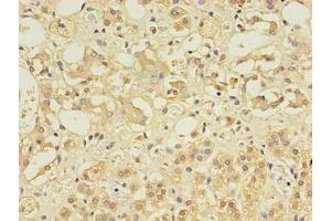 Immunohistochemistry of paraffin-embedded human adrenal gland tissue using ABIN7148084 at dilution of 1:100 (CCDC134 Antikörper  (AA 23-229))