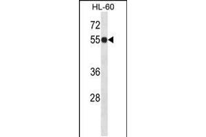 Western blot analysis in HL-60 cell line lysates (35ug/lane). (IMPDH1 Antikörper  (N-Term))