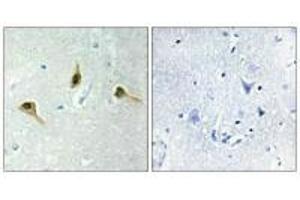 Immunohistochemistry analysis of paraffin-embedded human brain tissue using MSH2 antibody. (MSH2 Antikörper)
