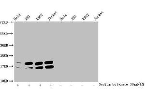 Western Blot Detected samples: Hela whole cell lysate, 293 whole cell lysate, K562 whole cell lysate, Jurkat whole cell lysate, Untreated (-) or treated (+) with 30 mM sodium butyrate for 4h All lanes: HIST1H1C antibody at 1:2000 Secondary Goat polyclonal to rabbit IgG at 1/40000 dilution Predicted band size: 22 kDa Observed band size: 22 kDa (HIST1H1C Antikörper  (acLys96))