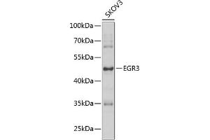 Western blot analysis of extracts of SKOV3 cells, using EGR3 antibody (ABIN6127828, ABIN6139993, ABIN6139994 and ABIN6223592) at 1:1000 dilution. (EGR3 Antikörper  (AA 1-250))