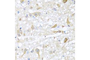 Immunohistochemistry of paraffin-embedded rat brain using CBR4 antibody (ABIN5972931) at dilution of 1/100 (40x lens). (CBR4 Antikörper)