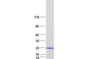 Validation with Western Blot (VPS25 Protein (Myc-DYKDDDDK Tag))