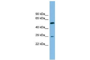 WB Suggested Anti-TM4SF20 Antibody Titration: 0. (TM4SF20 Antikörper  (Middle Region))