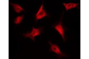 ABIN6269220 staining SW626 by IF/ICC. (CTNNB1 Antikörper  (N-Term))