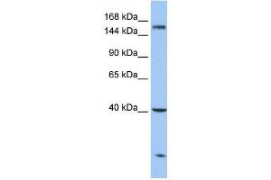 Carboxypeptidase D antibody used at 1 ug/ml to detect target protein. (CPD Antikörper  (N-Term))