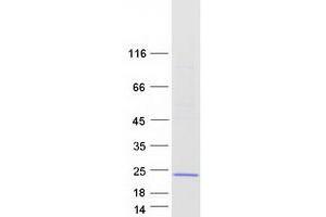 Western Blotting (WB) image for LIM Domain Only 2 (Rhombotin-Like 1) (LMO2) (Transcript Variant 2) protein (Myc-DYKDDDDK Tag) (ABIN2730873)