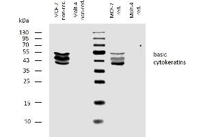 Western blotting analysis of human basic cytokeratins using mouse monoclonal antibody AE3 on lysates of MCF-7 cell line and Molt-4 cell line (cytokeratin non-expressing cell line, negative control) under non-reducing and reducing conditions. (Keratin Basic Antikörper)