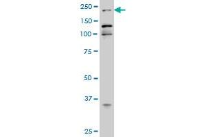 EP300 monoclonal antibody (M02), clone 1D2 Western Blot analysis of EP300 expression in Hela S3 NE . (p300 Antikörper  (AA 731-830))
