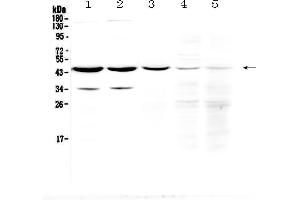 Western blot analysis of HOMER3 using anti-HOMER3 antibody .