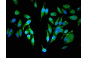 Immunofluorescent analysis of Hela cells using ABIN7147451 at dilution of 1:100 and Alexa Fluor 488-congugated AffiniPure Goat Anti-Rabbit IgG(H+L) (CEP25 (AA 40-293) Antikörper)